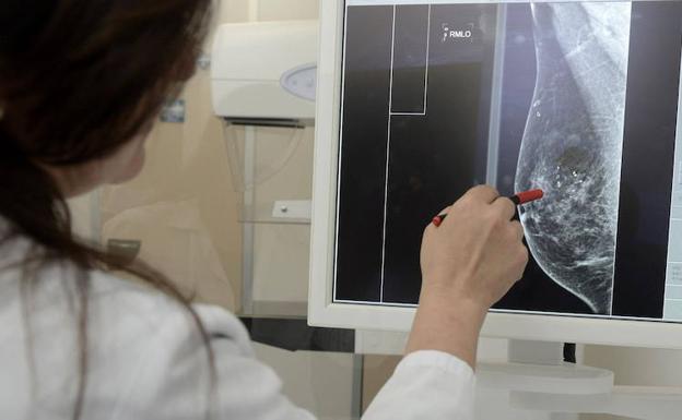 Una radióloga de un centro hospitalario de la región comprueba una mamografía digital. /El Norte