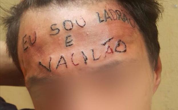 Tatúan la frente de un adolescente con «Soy un ladrón y un vacilón»