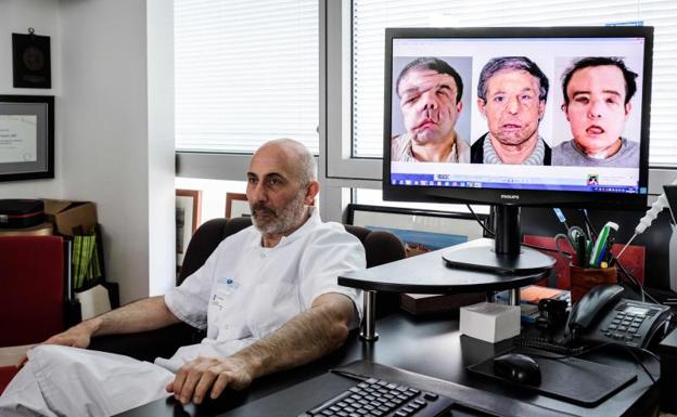 El hombre de las 'tres caras' habla tras un nuevo trasplante