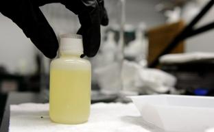 Qué significa cada color de tu orina y qué dice sobre tu salud