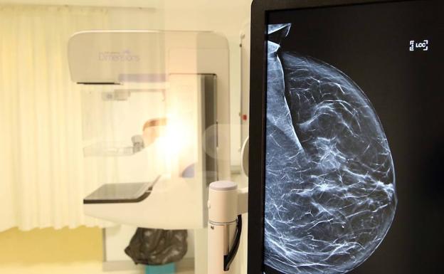 El Hospital de Segovia estrenará un segundo mamógrafo digital
