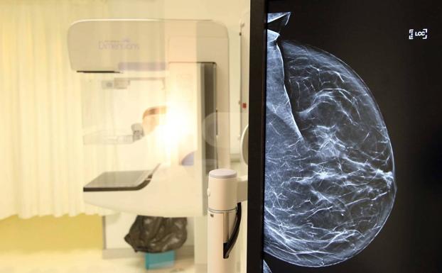 Quince mamógrafos se suman al equipamiento de Sacyl gracias a la Fundación Amancio Ortega