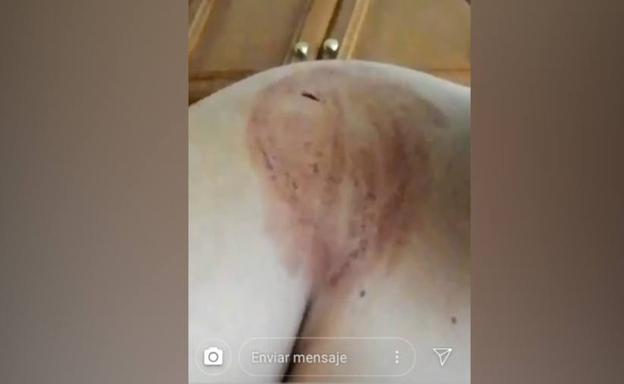 Un testigo apunta que la agresión del Húmedo fue en respuesta a tres navajazos que le asestó a un menor