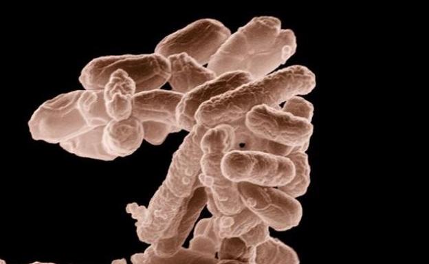 ¿Qué es la bacteria escherichia coli que invade la costa valenciana?