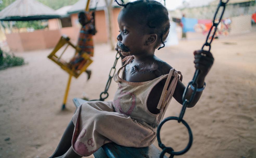 La peor cara de la miseria