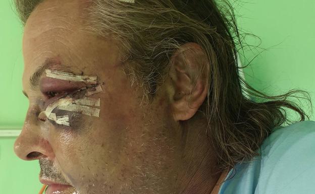 «Se lió a puñetazo limpio y casi me mata por conseguir un móvil viejo»
