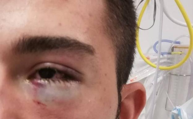 «Tengo claro que lo tiró una persona; venía con una fuerza descomunal»