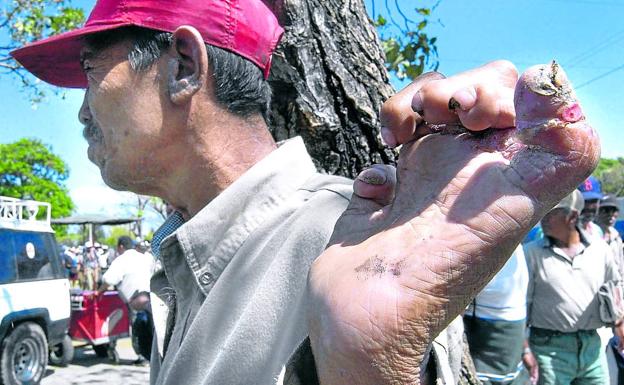 Justicia universal al asesino de esperma