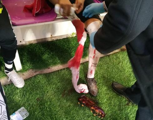 Seis puntos de sutura para Néstor Calderón en el Salamanca CF UDS tras un alarmante corte en la pierna