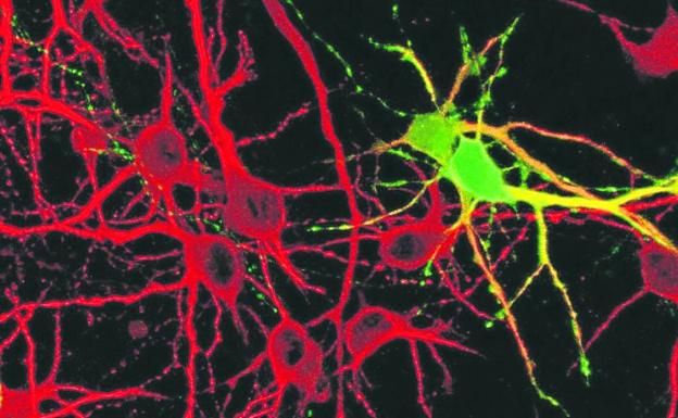 Tras las claves para combatir el ictus y el alzhéimer en Salamanca