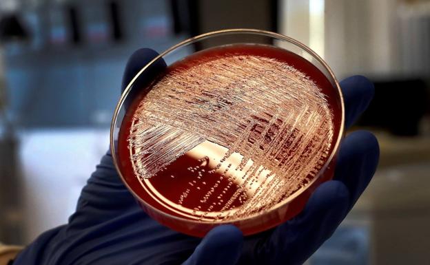 Millonaria fianza civil para los empresarios que causaron el brote de listeria en Andalucía