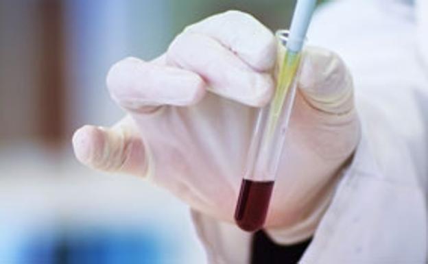 La Usal propone hacer test PCR para la comunidad universitaria y para la sociedad salmantina en colaboración con las distintas instituciones