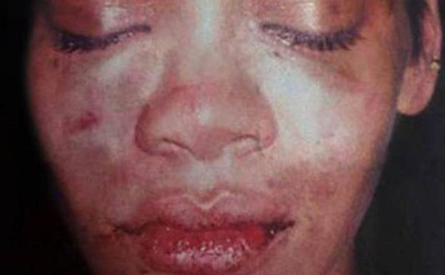Rihanna no descarta reconciliarse con Chris Brown, a pesar de la paliza que éste le propinó en 2009