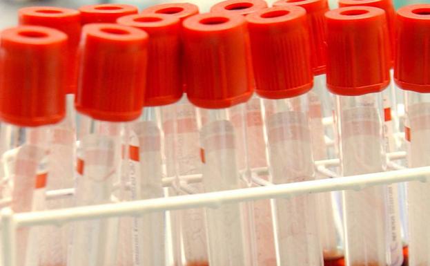 Médicos rurales piden a sus pacientes que aplacen analíticas porque el servicio está «saturado»