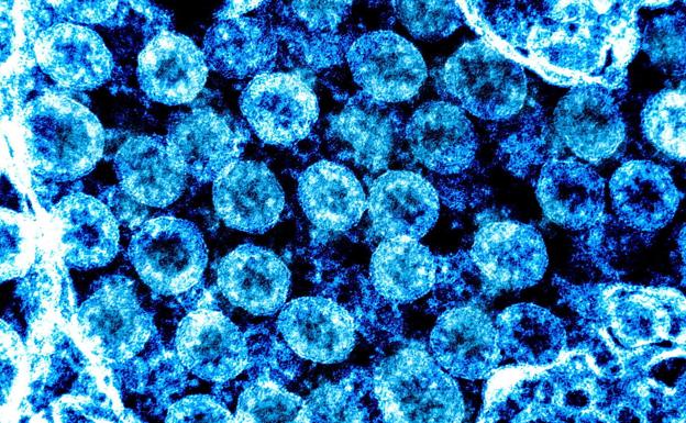 Investigadores de la Universidad de Burgos hallaron coronavirus en 2019 en Brasil