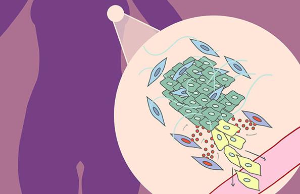 Investigadores del Centro del Cáncer de Salamanca relacionan el gen SNAI2 con la progresión del cáncer de mama