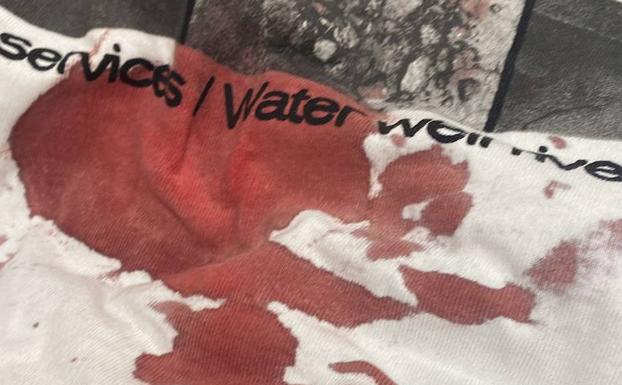 Dan una paliza al hijo de la exprocuradora Marta Sanz en las fiestas de Arroyo