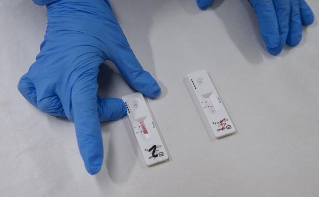 Test de orina, la nueva forma de saber si has tenido covid