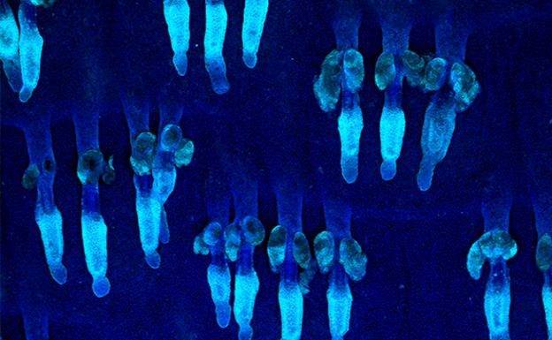 El Centro de Investigación del Cáncer identifica dos proteínas que modulan el comportamiento de las células madre de la piel