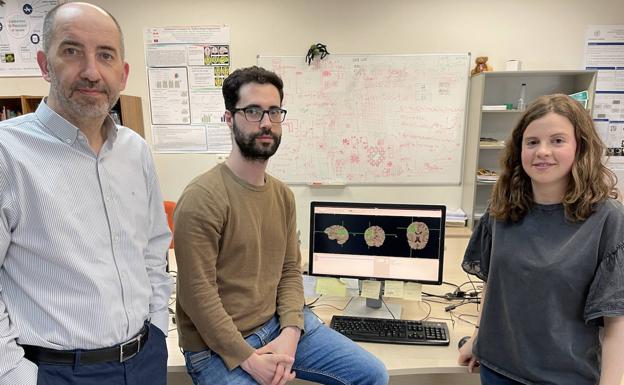 Crean en la UVA un sistema que mejorará el diagnóstico de uno de los cánceres más agresivos