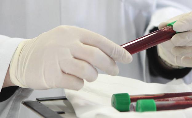 Castilla y León solo busca 12 de las 44 patologías detectables con la prueba del talón