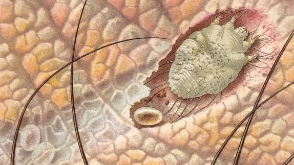 Seis trabajadores de un hospital de Huelva están afectados por un brote de sarna