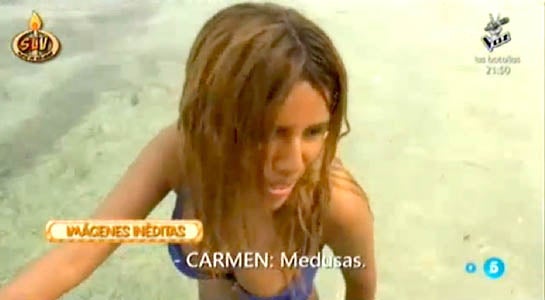 Chabelita y Rafi Camino, atacados por las medusas en 'Supervivientes 2015'