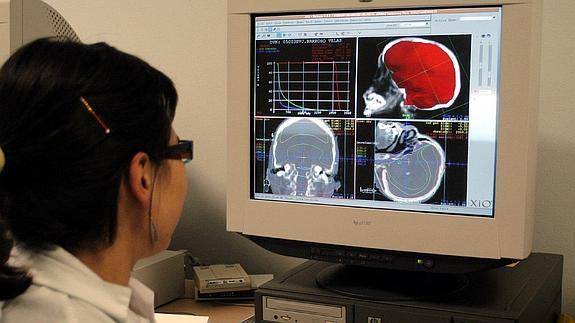 El PSOE exige a la Junta la instalación de la unidad de radioterapia en Segovia