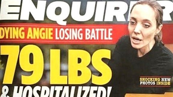 Angelina Jolie, ingresada por extrema delgadez