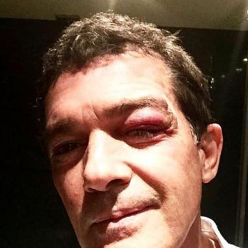 Antonio Banderas se parte la cara