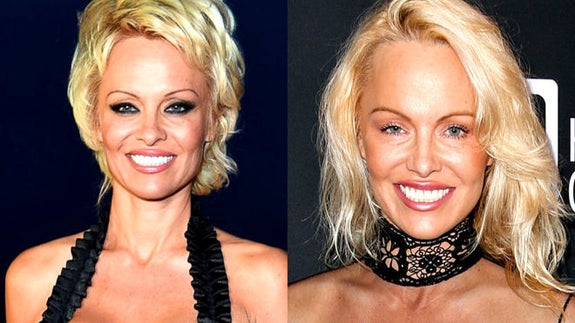 Pamela Anderson se pasa con la cirugía