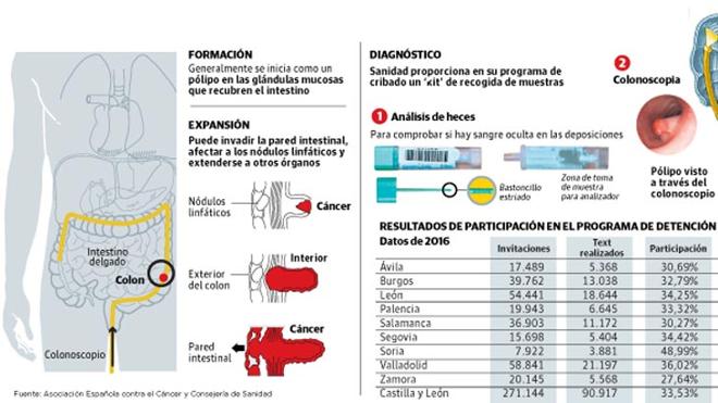 Lo que hay que saber del cáncer de colon y recto